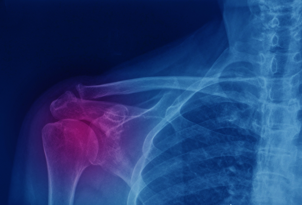 elbow surgery in gurgaon